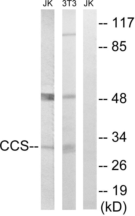 CCS Antibody - Western blot analysis of extracts from Jurkat cells and 3T3 cells, using CCS antibody.