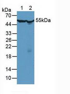 CCT2 / CCT Beta Antibody - Western Blot; Sample: Lane1: Human Hela Cells; Lane2: Mouse Testis Tissue.