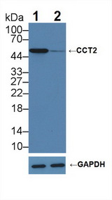 CCT2 / CCT Beta Antibody - Knockout Varification: Lane 1: Wild-type Hela cell lysate; Lane 2: CCT2 knockout Hela cell lysate; Predicted MW: 57,53kd Observed MW: 55kd Primary Ab: 1µg/ml Rabbit Anti-Human CCT2 Antibody Second Ab: 0.2µg/mL HRP-Linked Caprine Anti-Rabbit IgG Polyclonal Antibody