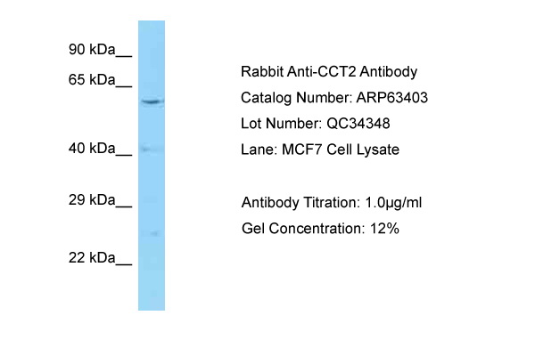 CCT2 / CCT Beta Antibody -  This image was taken for the unconjugated form of this product. Other forms have not been tested.