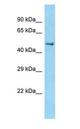 CCT2 / CCT Beta Antibody - CCT Beta / CCT2 antibody Western Blot of Mouse WT brain.  This image was taken for the unconjugated form of this product. Other forms have not been tested.