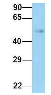 CCT2 / CCT Beta Antibody - CCT Beta / CCT2 antibody Western Blot of Human Fetal Lung. Antibody Dilution: 1.0 ug/ml. Antibody dilution: 1 ug/ml.  This image was taken for the unconjugated form of this product. Other forms have not been tested.