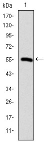 CCT2 / CCT Beta Antibody - Western blot using CCT2 monoclonal antibody against human CCT2 (AA: 87-290) recombinant protein. (Expected MW is 47.9 kDa)