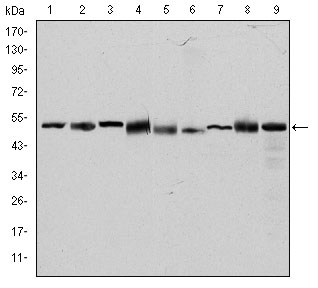 CCT2 / CCT Beta Antibody - Western blot using CCT2 mouse monoclonal antibody against HeLa (1), MCF-7 (2), Jurkat (3), T47D (4), K562 (5), A431 (6), NIH/3T3 (7), PC-12 (8) and Cos7 (9) cell lysate.