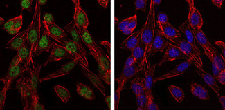 CCT2 / CCT Beta Antibody - Immunofluorescence of 3T3-L1 cells using CCT2 mouse monoclonal antibody (green). Blue: DRAQ5 fluorescent DNA dye. Red: Actin filaments have been labeled with Alexa Fluor-555 phalloidin.