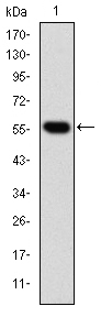 CCT2 / CCT Beta Antibody - Western blot using CCT2 monoclonal antibody against human CCT2 (AA: 87-290) recombinant protein. (Expected MW is 47.9 kDa)