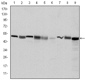 CCT2 / CCT Beta Antibody - Western blot using CCT2 mouse monoclonal antibody against HeLa (1), MCF-7 (2), Jurkat (3), T47D (4), K562 (5), A431 (6), NIH/3T3 (7), PC-12 (8) and Cos7 (9) cell lysate.