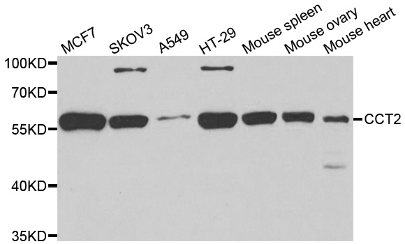 CCT2 / CCT Beta Antibody - Western blot analysis of extracts of various cell lines.