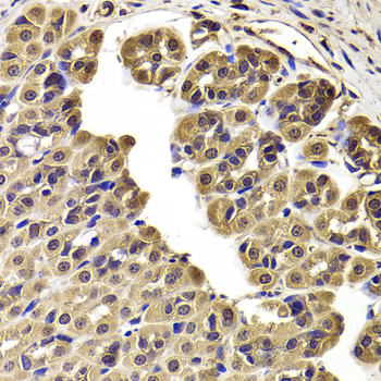 CCT2 / CCT Beta Antibody - Immunohistochemistry of paraffin-embedded Rat stomach tissue.