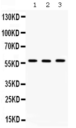 CCT2 / CCT Beta Antibody - Western blot - Anti-TCP1 beta Picoband Antibody