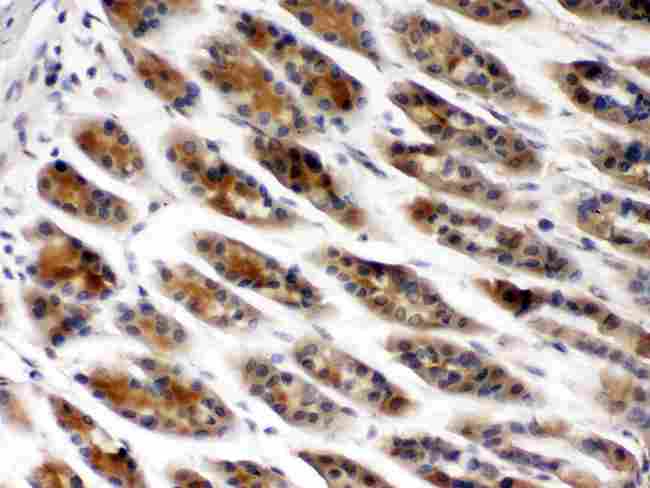 CCT2 / CCT Beta Antibody - TCP1 beta was detected in paraffin-embedded sections of mouse gaster tissues using rabbit anti- TCP1 beta Antigen Affinity purified polyclonal antibody