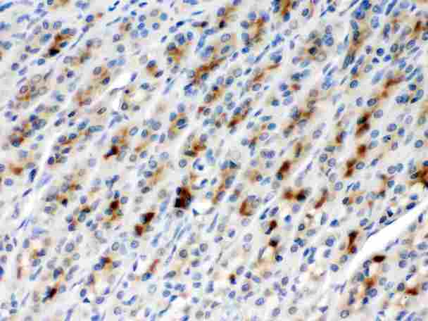 CCT2 / CCT Beta Antibody - TCP1 beta was detected in paraffin-embedded sections of rat gaster tissues using rabbit anti- TCP1 beta Antigen Affinity purified polyclonal antibody