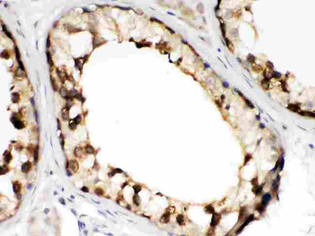 CCT2 / CCT Beta Antibody - TCP1 beta was detected in paraffin-embedded sections of human testis tissues using rabbit anti- TCP1 beta Antigen Affinity purified polyclonal antibody