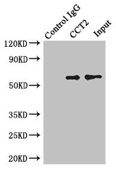 CCT2 / CCT Beta Antibody - Immunoprecipitating CCT2 in Jurkat whole cell lysate Lane 1: Rabbit monoclonal IgG(1ug)instead of product in Jurkat whole cell lysate.For western blotting, a HRP-conjugated light chain specific antibody was used as the Secondary antibody (1/50000) Lane 2: product(4ug)+ Jurkat whole cell lysate(500ug) Lane 3: Jurkat whole cell lysate (20ug)