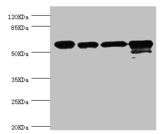 CCT2 / CCT Beta Antibody - Western blot All Lanes:CCT2 antibody at 5.63ug/ml Lane 1:Jurkat whole cell lysate Lane 2:NIH3T3 whole cell lysate Lane 3:MCF-7 whole cell lysate Lane 4:K562 whole cell lysate Secondary Goat polyclonal to rabbit at 1/10000 dilution Predicted band size: 58,53 kDa Observed band size: 57 kDa