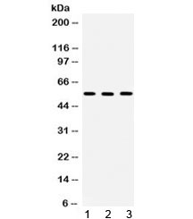 CCT2 / CCT Beta Antibody - Western blot testing of 1) rat testis, 2) mouse spleen and 3) human SW620 lysate with TCP1 beta antibody. Predicted/observed molecular weight ~57 kDa.