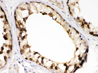 CCT2 / CCT Beta Antibody - IHC testing of FFPE human testis with TCP1 beta antibody at 1ug/ml. HIER: steam in pH6 citrate buffer and allow to cool prior to staining.