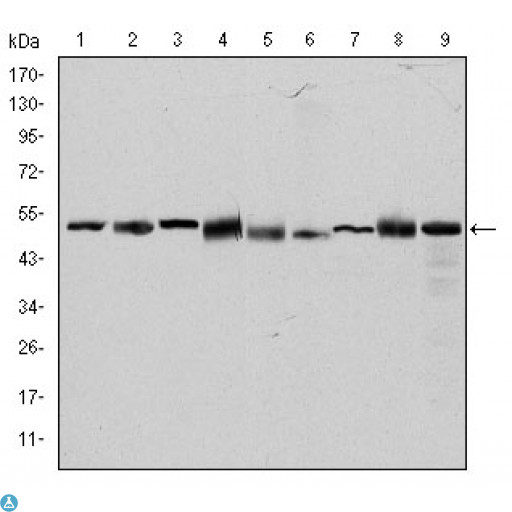 CCT2 / CCT Beta Antibody - Western Blot (WB) analysis using TCP-1 beta Monoclonal Antibody against HeLa (1), MCF-7 (2), Jurkat (3), T47D (4), K562 (5), A431 (6), NIH/3T3 (7), PC-12 (8) and Cos7 (9) cell lysate.