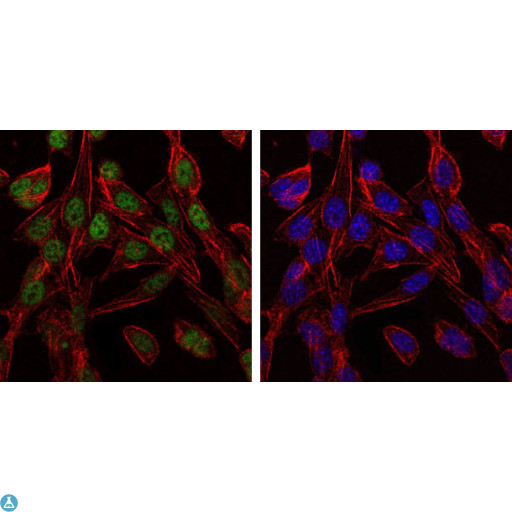 CCT2 / CCT Beta Antibody - Immunofluorescence (IF) analysis of 3T3-L1 cells using TCP-1 beta Monoclonal Antibody (green). Blue: DRAQ5 fluorescent DNA dye. Red: Actin filaments have been labeled with Alexa Fluor-555 phalloidin.