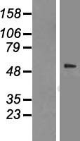 CCT2 / CCT Beta Protein - Western validation with an anti-DDK antibody * L: Control HEK293 lysate R: Over-expression lysate