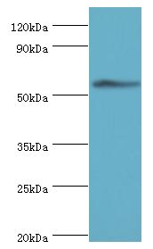 CCT3 Antibody - Western blot. All lanes: T-complex protein 1 subunit gamma antibody at 12 ug/ml+mouse brain tissue. Secondary antibody: Goat polyclonal to rabbit at 1:10000 dilution. Predicted band size: 61 kDa. Observed band size: 61 kDa.