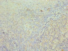 CCT3 Antibody - Immunohistochemistry of paraffin-embedded human tonsil tissue using CCT3 Antibody at dilution of 1:100