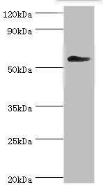 CCT3 Antibody - Western blot All lanes: T-complex protein 1 subunit gamma antibody at 12µg/ml + Mouse brain tissue Secondary Goat polyclonal to rabbit IgG at 1/10000 dilution Predicted band size: 61, 57 kDa Observed band size: 61 kDa