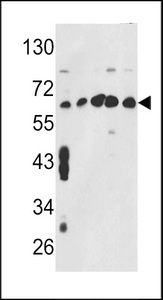 CCT3 Antibody - Western blot of CCT3 Antibody in MCF7,CEM,K562,HL-60,HeLa cell line lysates (35 ug/lane). CCT3 (arrow) was detected using the purified antibody.
