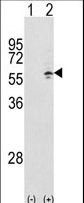 CCT3 Antibody - Western blot of CCT3 (arrow) using rabbit polyclonal CCT3 Antibody. 293 cell lysates (2 ug/lane) either nontransfected (Lane 1) or transiently transfected with the CCT3 gene (Lane 2).