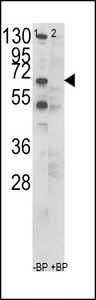 CCT3 Antibody - Western blot of CCT3 Antibody in K562 cell line lysates (35 ug/lane). CCT3 (arrow) was detected using the purified antibody.