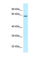 CCT3 Antibody - CCT3 antibody Western blot of Placenta lysate. Antibody concentration 1 ug/ml.  This image was taken for the unconjugated form of this product. Other forms have not been tested.