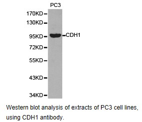 CCT3 Antibody - Western blot.
