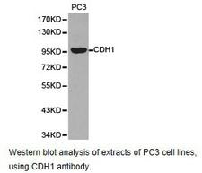 CCT3 Antibody - Western blot.