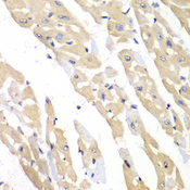 CCT3 Antibody - Immunohistochemistry of paraffin-embedded mouse heart.