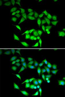 CCT3 Antibody - Immunofluorescence analysis of U20S cells.