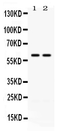 CCT3 Antibody - Western blot - Anti-CCT3/Tcp 1 Gamma Picoband Antibody