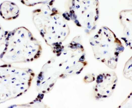 CCT3 Antibody - IHC analysis of CCT3 using anti-CCT3 antibody. CCT3 was detected in paraffin-embedded section of human placenta tissue. Heat mediated antigen retrieval was performed in citrate buffer (pH6, epitope retrieval solution) for 20 mins. The tissue section was blocked with 10% goat serum. The tissue section was then incubated with 1µg/ml rabbit anti-CCT3 Antibody overnight at 4°C. Biotinylated goat anti-rabbit IgG was used as secondary antibody and incubated for 30 minutes at 37°C. The tissue section was developed using Strepavidin-Biotin-Complex (SABC) with DAB as the chromogen.