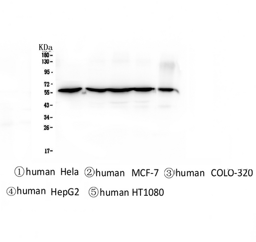 CCT3 Antibody - Western blot analysis of CCT3 using anti-CCT3 antibody. Electrophoresis was performed on a 5-20% SDS-PAGE gel at 70V (Stacking gel) / 90V (Resolving gel) for 2-3 hours. The sample well of each lane was loaded with 50ug of sample under reducing conditions. Lane 1: human Hela whole cell lysates, Lane 2: human MCF-7 whole cell lysates, Lane 3: human COLO-320 whole cell lysates, Lane 4: human HepG2 whole cell lysates. After Electrophoresis, proteins were transferred to a Nitrocellulose membrane at 150mA for 50-90 minutes. Blocked the membrane with 5% Non-fat Milk/ TBS for 1.5 hour at RT. The membrane was incubated with mouse anti-CCT3 antigen affinity purified monoclonal antibody at 0.5 µg/mL overnight at 4°C, then washed with TBS-0.1% Tween 3 times with 5 minutes each and probed with a Biotin Conjugated goat anti-mouse IgG secondary antibody at a dilution of 1:10000 for 1.5 hour at RT. The signal is developed using an Enhanced Chemiluminescent detection (ECL) kit with Tanon 5200 system.