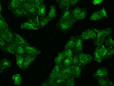 CCT3 Antibody - Immunofluorescence staining of CCT3 in U2OS cells. Cells were fixed with 4% PFA, permeabilzed with 0.1% Triton X-100 in PBS, blocked with 10% serum, and incubated with rabbit anti-Human CCT3 polyclonal antibody (dilution ratio 1:500) at 4°C overnight. Then cells were stained with the Alexa Fluor 488-conjugated Goat Anti-rabbit IgG secondary antibody (green). Positive staining was localized to Cytoplasm.