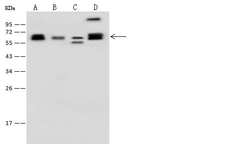 CCT3 Antibody - Anti-CCT3 rabbit polyclonal antibody at 1:500 dilution. Lane A: K562 Whole Cell Lysate. Lane B: HL-60 Whole Cell Lysate. Lane C: HeLa Whole Cell Lysate. Lane D: Jurkat Whole Cell Lysate. Lysates/proteins at 30 ug per lane. Secondary: Goat Anti-Rabbit IgG (H+L)/HRP at 1/10000 dilution. Developed using the ECL technique. Performed under reducing conditions. Predicted band size: 61 kDa. Observed band size: 61 kDa.