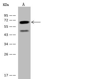 CCT3 Antibody - Anti-CCT3 rabbit polyclonal antibody at 1:500 dilution. Lane A: Jurkat Whole Cell Lysate. Lysates/proteins at 30 ug per lane. Secondary: Goat Anti-Rabbit IgG (H+L)/HRP at 1/10000 dilution. Developed using the ECL technique. Performed under reducing conditions. Predicted band size: 61 kDa. Observed band size: 61 kDa.