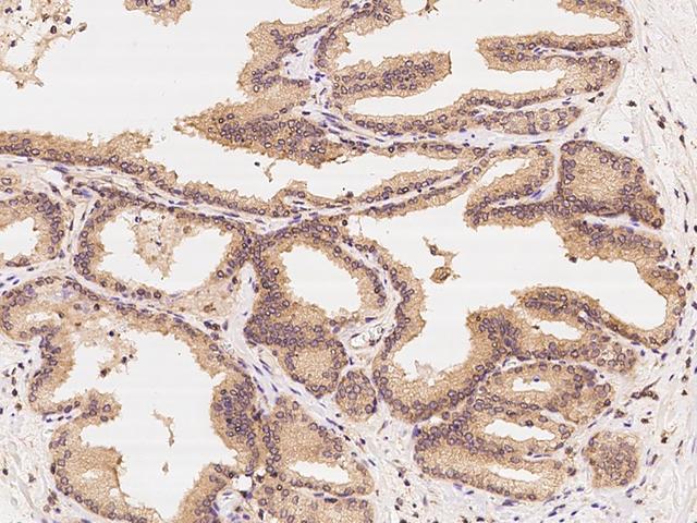 CCT3 Antibody - Immunochemical staining of human CCT3 in human prostate with rabbit polyclonal antibody at 1:300 dilution, formalin-fixed paraffin embedded sections.