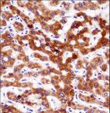 CCT4 / SRB Antibody - CCT4 Antibody immunohistochemistry of formalin-fixed and paraffin-embedded human liver tissue followed by peroxidase-conjugated secondary antibody and DAB staining.