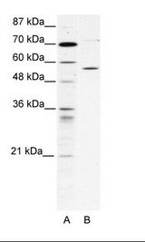CCT4 / SRB Antibody - A: Marker, B: HepG2 Cell Lysate.  This image was taken for the unconjugated form of this product. Other forms have not been tested.