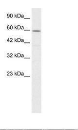 CCT4 / SRB Antibody - HepG2 Cell Lysate.  This image was taken for the unconjugated form of this product. Other forms have not been tested.