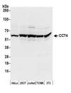 CCT4 / SRB Antibody - Detection of human and mouse CCT4 by western blot. Samples: Whole cell lysate (50 µg) from HeLa, HEK293T, Jurkat, mouse TCMK-1, and mouse NIH 3T3 cells prepared using NETN lysis buffer. Antibodies: Affinity purified rabbit anti-CCT4 antibody used for WB at 0.4 µg/ml. Detection: Chemiluminescence with an exposure time of 10 seconds.