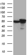 CCT4 / SRB Antibody - HEK293T cells were transfected with the pCMV6-ENTRY control. (Left lane) or pCMV6-ENTRY CCT4. (Right lane) cDNA for 48 hrs and lysed