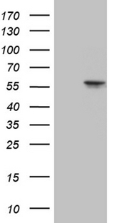 CCT4 / SRB Antibody - HEK293T cells were transfected with the pCMV6-ENTRY control. (Left lane) or pCMV6-ENTRY CCT4. (Right lane) cDNA for 48 hrs and lysed. Equivalent amounts of cell lysates. (5 ug per lane) were separated by SDS-PAGE and immunoblotted with anti-CCT4. (1:2000)