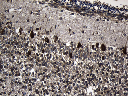CCT4 / SRB Antibody - Immunohistochemical staining of paraffin-embedded Human embryonic cerebellum within the normal limits using anti-CCT4 mouse monoclonal antibody. (Heat-induced epitope retrieval by 1mM EDTA in 10mM Tris buffer. (pH8.5) at 120 oC for 3 min. (1:150)
