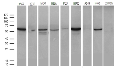 CCT4 / SRB Antibody - Western blot analysis of extracts. (35ug) from 9 different cell lines by using anti-CCT4 monoclonal antibody. (1:500)